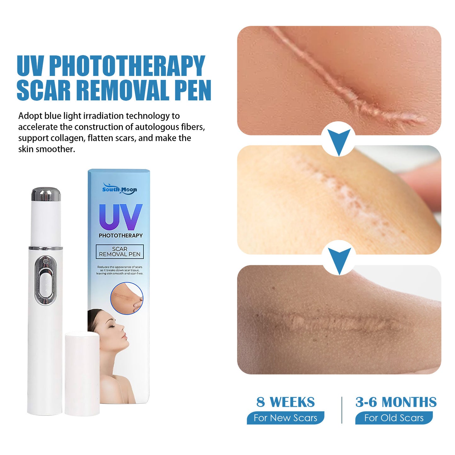 UV Light Scar Pen - Gentle Fade & Repair