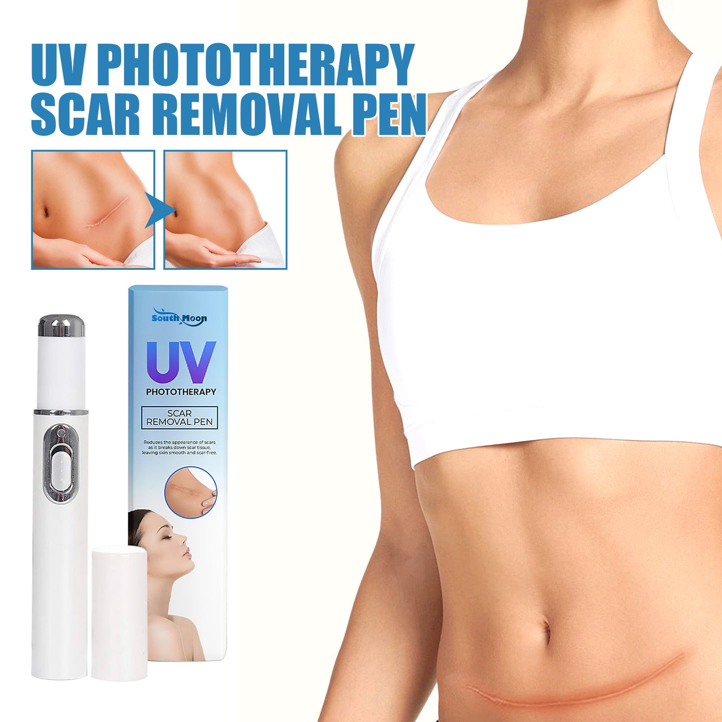 UV Light Scar Pen - Gentle Fade & Repair
